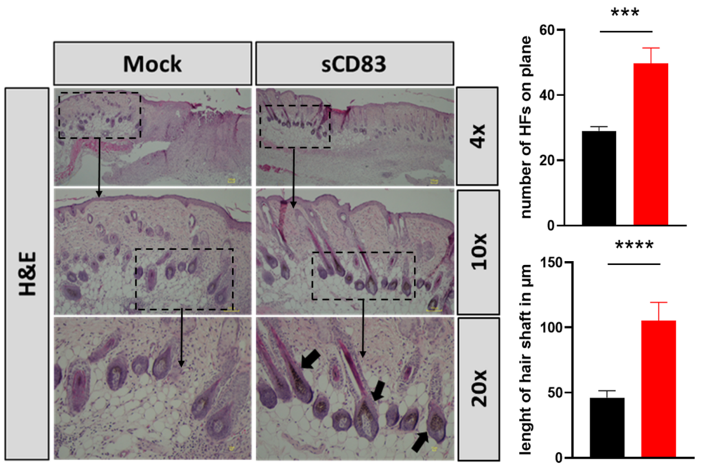 Figure 2: sCD83 boosts new hair follicle formation.